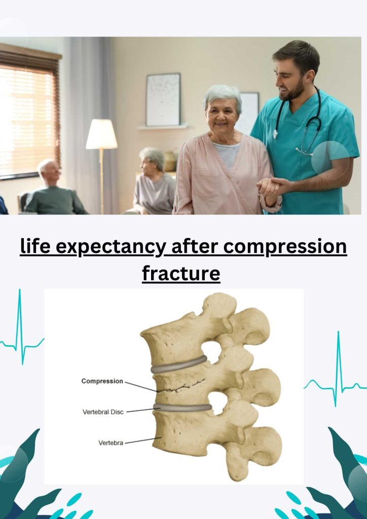 Life Expectancy After Compression Fracture